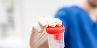 ¿Qué revela la orina? Un examen simple que puede detectar desde infecciones hasta diabetes Qué revela la orina