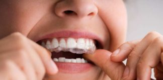 Uso de férulas para bruxismo sin supervisión odontológica puede generar complicaciones graves
