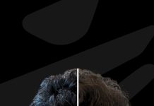 Boom de los implantes capilares en Chile: una solución cada vez más definitiva para dejar atrás la pérdida de cabello Boom de los implantes capilares en Chile