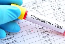Colesterol: lo que dicen los exámenes más allá de un número Colesterol: lo que dicen los exámenes más allá de un número