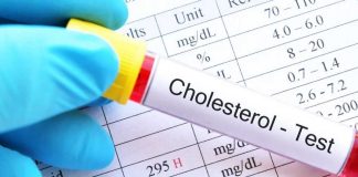 Colesterol: lo que dicen los exámenes más allá de un número