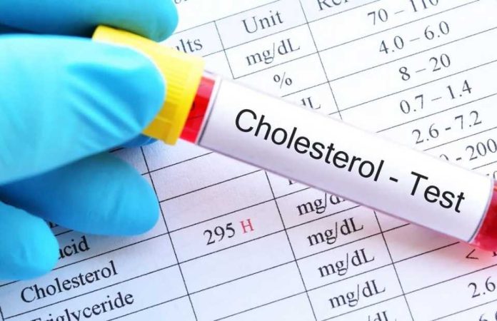 Colesterol lo que dicen los exámenes más allá de un número Colesterol: lo que dicen los exámenes más allá de un número