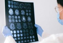 Tu cerebro nunca descansa: así puedes cuidarlo Tu cerebro nunca descansa: así puedes cuidarlo