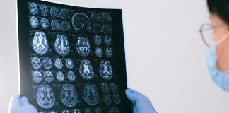 Tu cerebro nunca descansa: así puedes cuidarlo