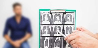 Fibrosis Pulmonar Idiopática: Cuando respirar se vuelve un desafío