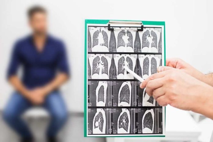 Fibrosis Pulmonar Idiopática: Cuando respirar se vuelve un desafío Fibrosis Pulmonar Idiopática: Cuando respirar se vuelve un desafío