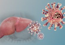 Hepatitis: la infección que avanza en silencio y puede ser mortal Hepatitis: la infección que avanza en silencio y puede ser mortal