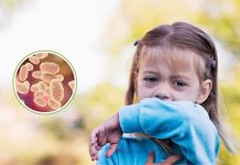 Preocupación por altos contagios de coqueluche: Síntomas y cómo prevenir esta peligrosa enfermedad Preocupación por altos contagios de coqueluche: Síntomas y cómo prevenir esta peligrosa enfermedad