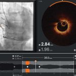 Ultreon 2.0 llega a Chile: la innovadora tecnología de inteligencia artificial para combatir las enfermedades cardiovasculares Ultreon 2.0 llega a Chile: la innovadora tecnología de inteligencia artificial para combatir las enfermedades cardiovasculares