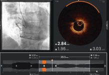 Ultreon 2.0 llega a Chile: la innovadora tecnología de inteligencia artificial para combatir las enfermedades cardiovasculares Ultreon 2.0 llega a Chile: la innovadora tecnología de inteligencia artificial para combatir las enfermedades cardiovasculares
