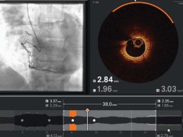 Ultreon 2.0 llega a Chile: la innovadora tecnología de inteligencia artificial para combatir las enfermedades cardiovasculares Ultreon 2.0 llega a Chile: la innovadora tecnología de inteligencia artificial para combatir las enfermedades cardiovasculares