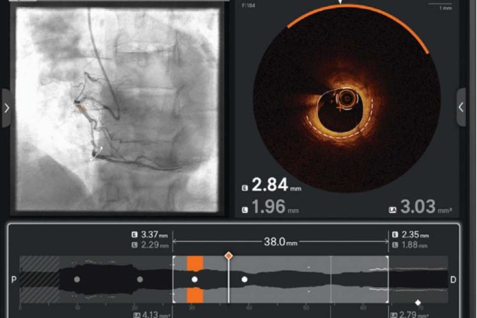 Ultreon 2.0 llega a Chile la innovadora tecnología de inteligencia artificial para combatir las enfermedades cardiovasculares Ultreon 2.0 llega a Chile: la innovadora tecnología de inteligencia artificial para combatir las enfermedades cardiovasculares