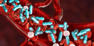 La sepsis no espera: Cómo actuar rápido frente a una infección generalizada La sepsis no espera: Cómo actuar rápido frente a una infección generalizada