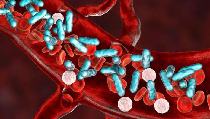 La sepsis no espera: Cómo actuar rápido frente a una infección generalizada