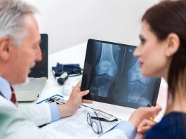 Día Mundial de la Osteoporosis: Experto explica los mitos y verdades de esta silenciosa enfermedad Día Mundial de la Osteoporosis: Experto explica los mitos y verdades de esta silenciosa enfermedad