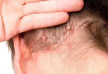 El efecto dominó más allá de la piel