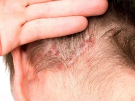 El efecto dominó más allá de la piel El efecto dominó más allá de la piel