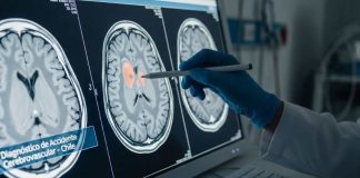 El reloj del ACV cada minuto cuenta