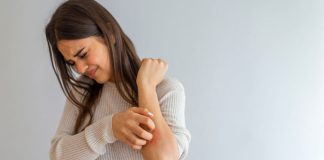 Encuesta revela grave impacto económico y desconocimiento en tratamientos para la Psoriasis