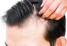 Fin al trauma de la alopecia en hombres Fin al trauma de la alopecia en hombres