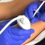 Hospital Roberto del Río utiliza bótox para transformar la movilidad de niños con parálisis cerebral Hospital Roberto del Río utiliza bótox para transformar la movilidad de niños con parálisis cerebral