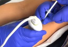 Hospital Roberto del Río utiliza bótox para transformar la movilidad de niños con parálisis cerebral Hospital Roberto del Río utiliza bótox para transformar la movilidad de niños con parálisis cerebral
