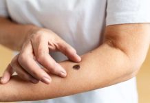 Inicio de la temporada de la araña de rincón: Cómo actuar y cuándo acudir a urgencias ante una picadura