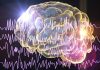 Innovación en el tratamiento de la epilepsia: Alternativas a la medicación buscan restablecer y reparar el cerebro, explica experto Innovación en el tratamiento de la epilepsia: Alternativas a la medicación buscan restablecer y reparar el cerebro, explica experto