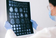 Investigación estudia cómo el cerebro adquiere experticia visual al procesar imágenes Investigación estudia cómo el cerebro adquiere experticia visual al procesar imágenes