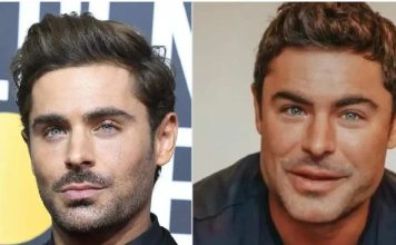 Pillow face o “cara de almohada”: qué es y cómo prevenirlo al usar rellenos faciales Pillow face o “cara de almohada”: qué es y cómo prevenirlo al usar rellenos faciales