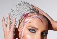 Qué es la alopecia universal femenina, la condición de la Miss Estados Unidos que emocionó al mundo al desfilar sin peluca Qué es la alopecia universal femenina, la condición de la Miss Estados Unidos que emocionó al mundo al desfilar sin peluca