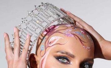 Qué es la alopecia universal femenina, la condición de la Miss Estados Unidos que emocionó al mundo al desfilar sin peluca