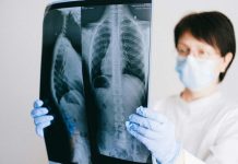 Cáncer de pulmón: Especialistas alertan aumento de casos en personas no fumadoras y llaman a reforzar la detección temprana Cáncer de pulmón: Especialistas alertan aumento de casos en personas no fumadoras y llaman a reforzar la detección temprana