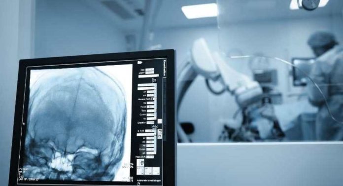 Cirugías cerebrales por vía nasal una técnica cada vez más frecuente y menos invasiva