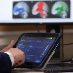 Mayo Clinic mapea ondas cerebrales de los pacientes para personalizar tratamiento de la epilepsia