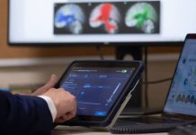 Mayo Clinic mapea ondas cerebrales de los pacientes para personalizar tratamiento de la epilepsia Mayo Clinic mapea ondas cerebrales de los pacientes para personalizar tratamiento de la epilepsia