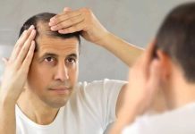 ¿Sufre de caída del cabello Sepa cuándo es tiempo de consultar a un médico