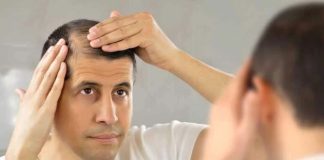 ¿Sufre de caída del cabello? Sepa cuándo es tiempo de consultar a un médico ¿Sufre de caída del cabello Sepa cuándo es tiempo de consultar a un médico