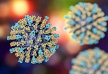 ¿Es un peligro la alerta por sarampión? Epidemióloga explica qué significa para Chile ¿Es un peligro la alerta por sarampión? Epidemióloga explica qué significa para Chile