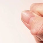 ¿Lipoma? Especialista en Salud explica qué es y cuándo consultar al médico