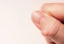 ¿Lipoma? Especialista en Salud explica qué es y cuándo consultar al médico