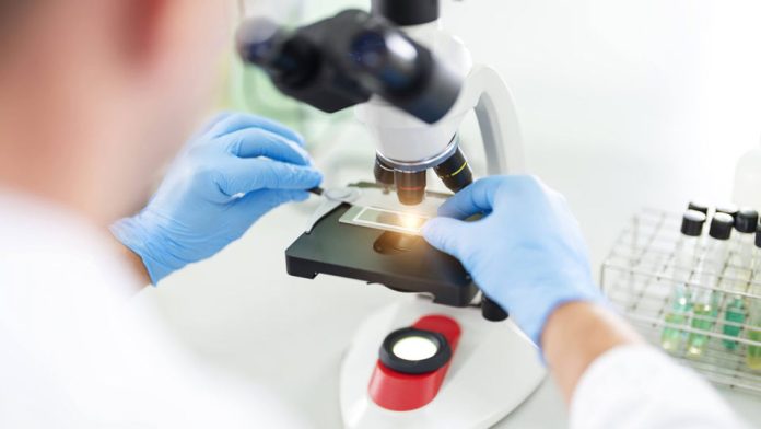 Investigadores de Mayo Clinic encuentran una nueva esperanza para el mieloma más difícil mediante inmunoterapia lista para usar Investigadores de Mayo Clinic encuentran una nueva esperanza para el mieloma más difícil mediante inmunoterapia lista para usar