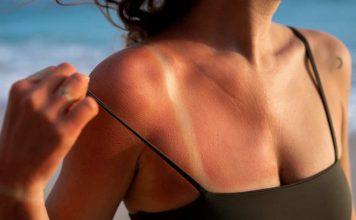 Verano y piel al límite: los problemas estéticos que más aumentan con el sol… y cómo prevenirlos