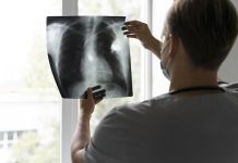 Día Mundial del Cáncer: cáncer de pulmón lidera la mortalidad en Chile, mientras nuevas terapias comienzan a cambiar el tratamiento Día Mundial del Cáncer: cáncer de pulmón lidera la mortalidad en Chile, mientras nuevas terapias comienzan a cambiar el tratamiento