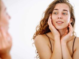 HealthTech chilena redefine la dermatología: diagnóstico y tratamiento asincrónico para el acné y la rosácea HealthTech chilena redefine la dermatología: diagnóstico y tratamiento asincrónico para el acné y la rosácea