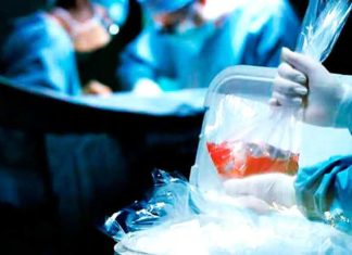La adherencia no es opcional: el desafío cotidiano de vivir con un órgano trasplantado