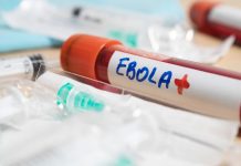 El brote de ébola más letal en la historia del Congo: qué lo hace distinto y por qué el riesgo para Chile es bajo