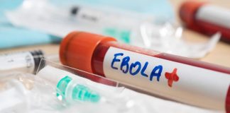 El brote de ébola más letal en la historia del Congo: qué lo hace distinto y por qué el riesgo para Chile es bajo