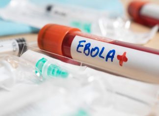 El brote de ébola más letal en la historia del Congo: qué lo hace distinto y por qué el riesgo para Chile es bajo