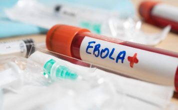 El brote de ébola más letal en la historia del Congo: qué lo hace distinto y por qué el riesgo para Chile es bajo